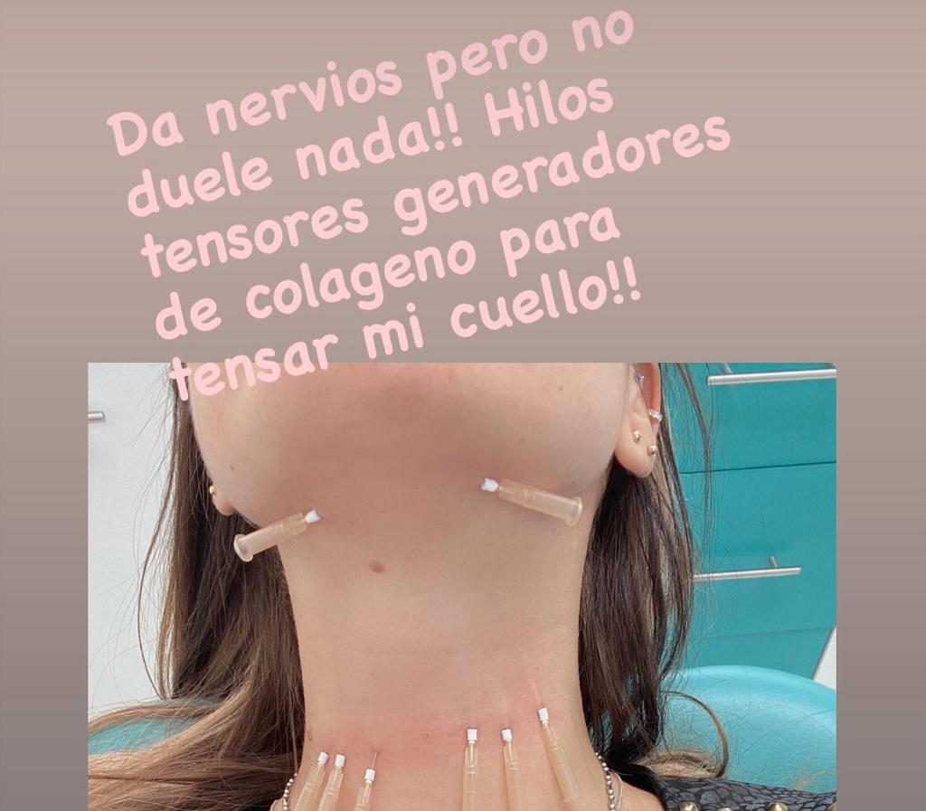 Fran Undurraga muestra lo que hace para tensar su cuello