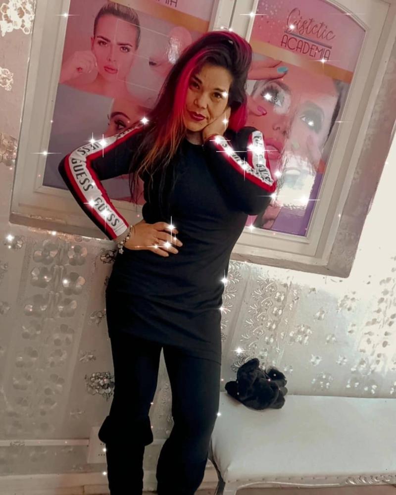 “Un regalo para mí”: Zapallito Italiano se operó sus senos