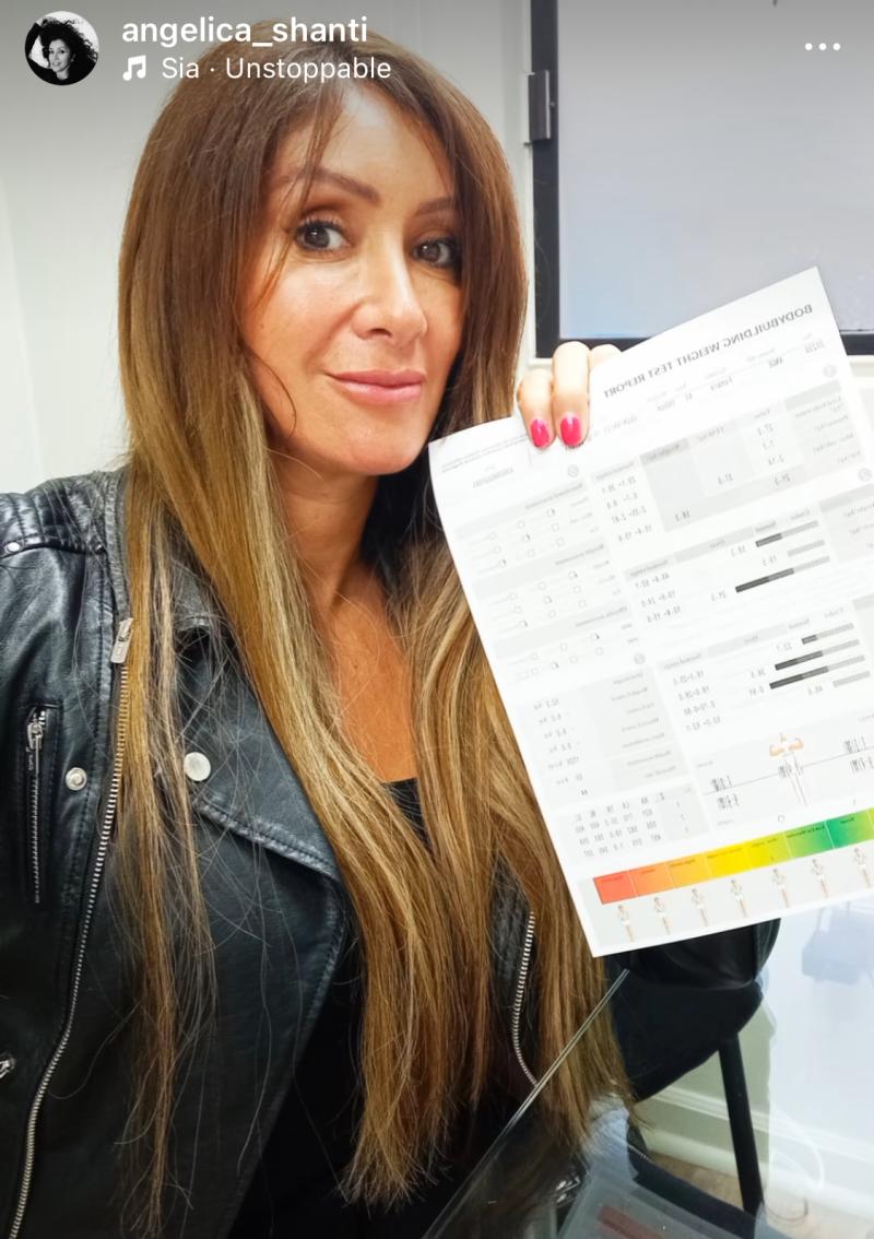 Angélica Sepúlveda se somete a importante tratamiento estético “Feliz