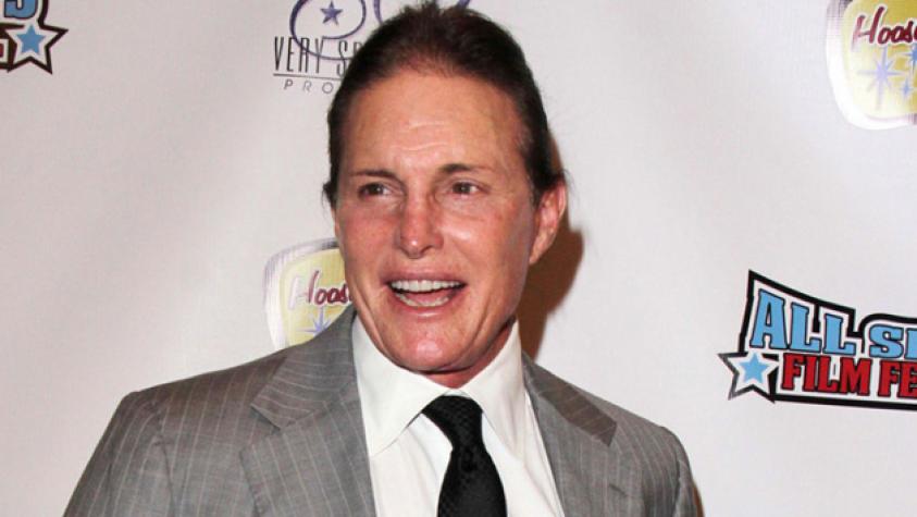 Aseguran que Bruce Jenner se puso implantes mamarios