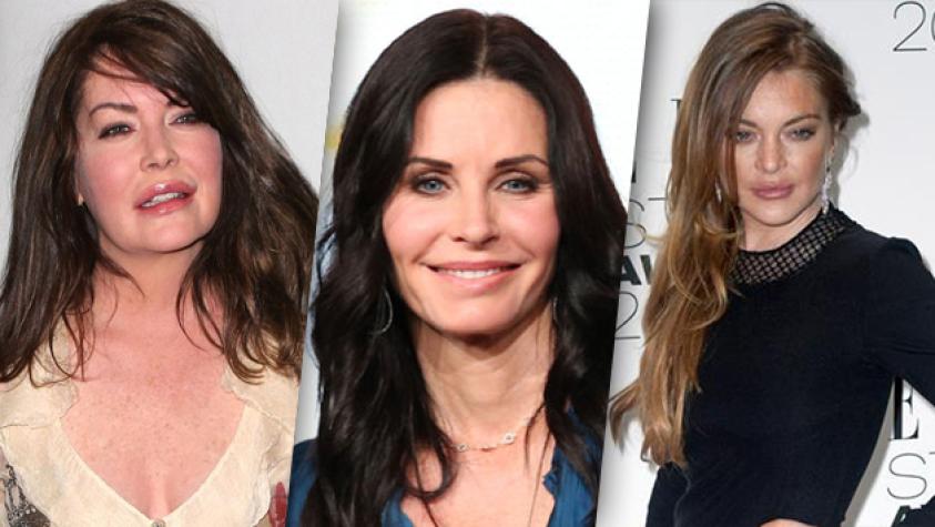 Estas famosas cambiaron su rostro por completo con cirugía