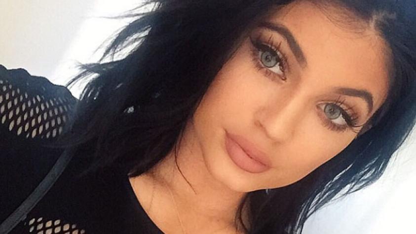 Desafío para tener los labios de Kylie Jenner termina con desastrosos resultados