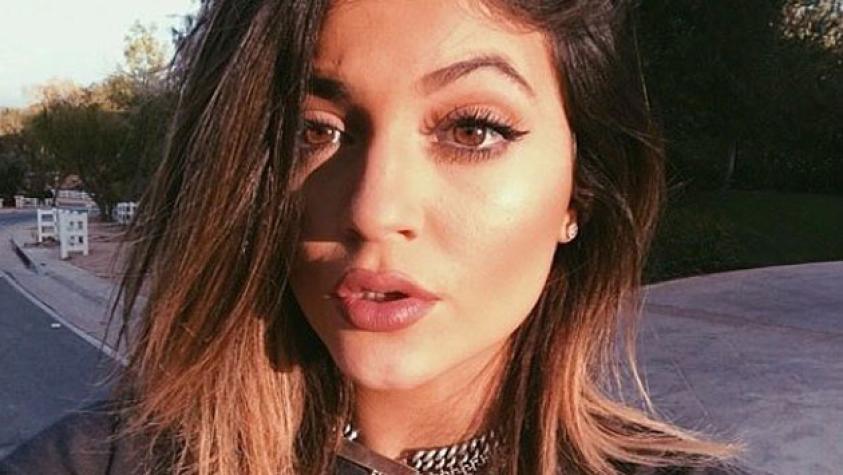 Kylie Jenner confiesa la verdad sobre sus famosos labios