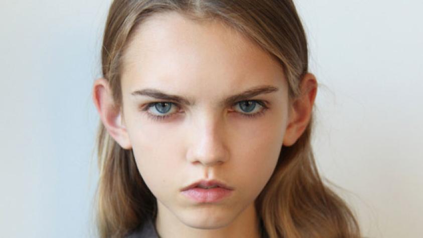 Joven que era llamada “cara de rata” se convirtió en supermodelo