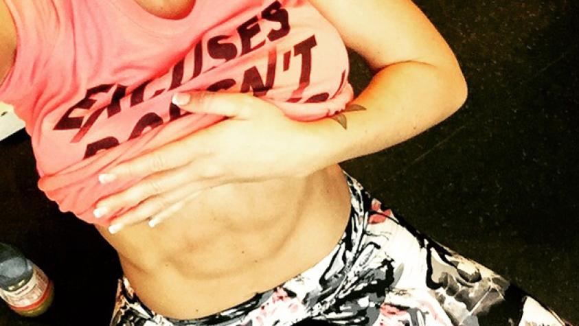 Famosas que tienen “calugas”