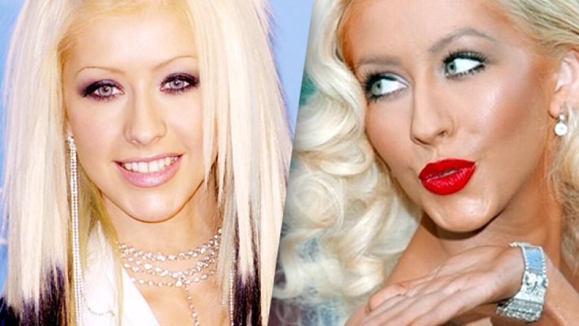 6 Famosas que han “inflado” sus labios