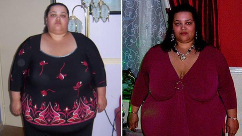 Mujer rechaza cirugía y baja 127 kilos por su cuenta