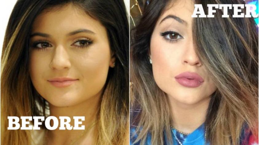 Mujer se somete a un correcto “Kylie Jenner Lip Challenge” digno de imitar