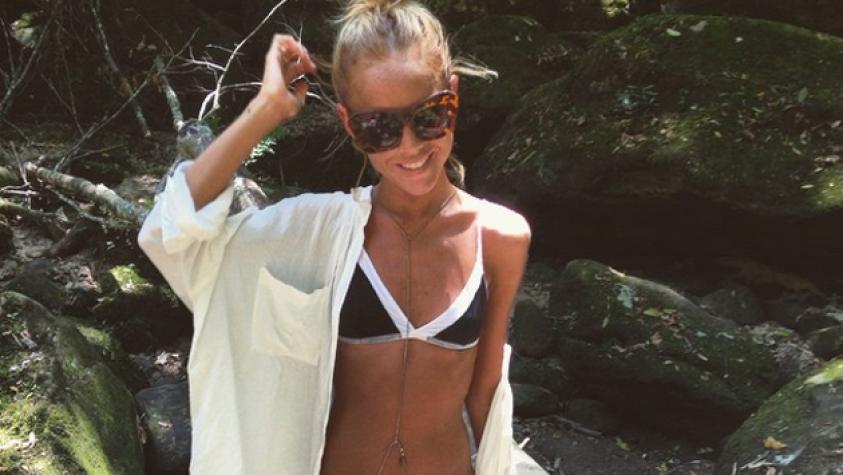 Mujer que se obsesionó con Miranda Kerr llegó a pesar 31 kilos