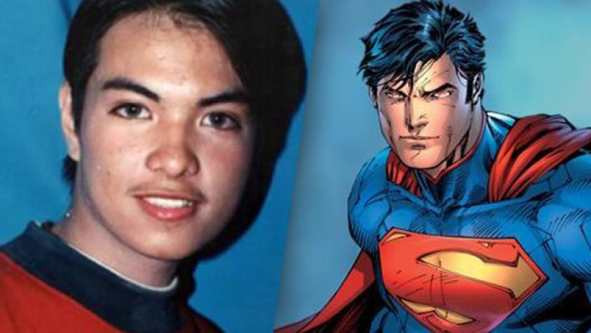 Hombre entró al quirófano 23 veces para parecerse a Clark Kent