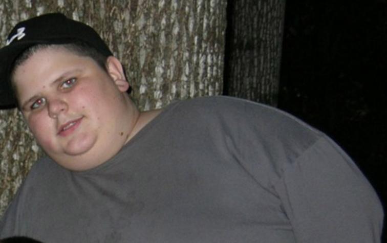 Joven que bajó 80 kilos se convierte en estrella de internet
