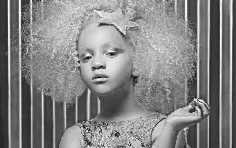 Niña albina de raza negra revoluciona el mundo de la moda