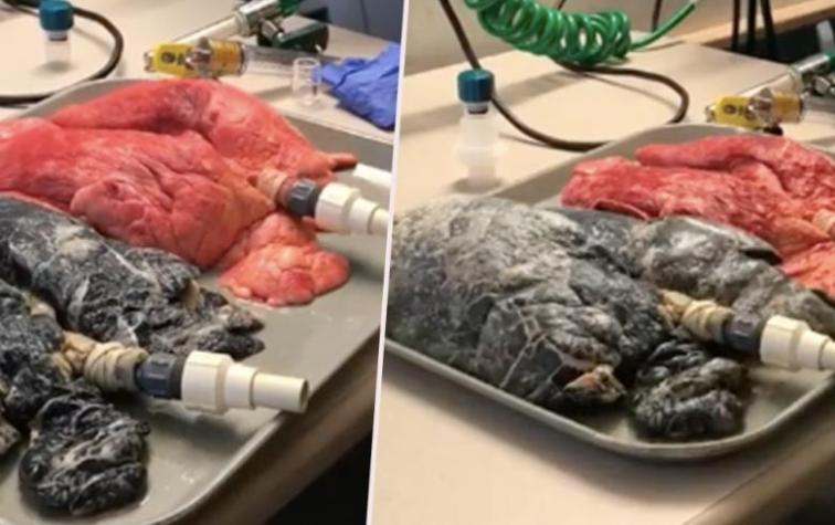 La brutal diferencia entre los pulmones de un fumador y unos sanos