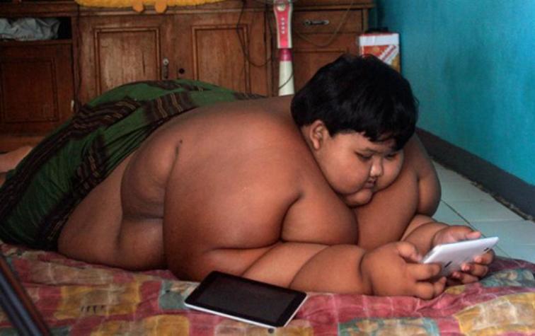 La radical transformación del “niño más gordo del mundo”