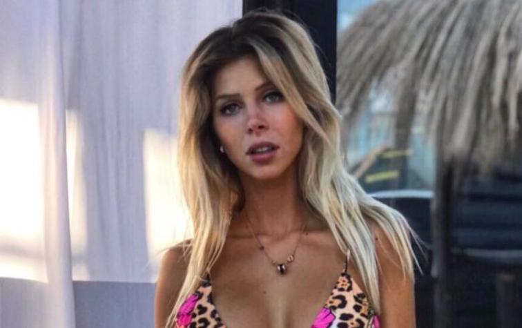 Romina Malaspina explica por qué se operó el rostro