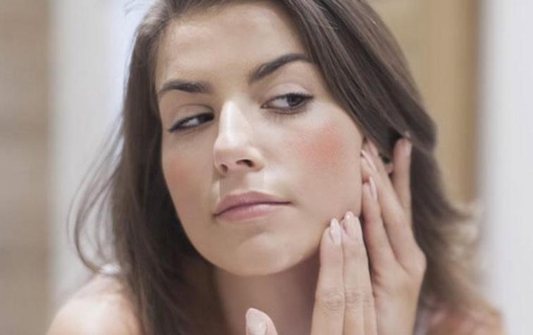 Dermatólogo responde las 6 preguntas más frecuentes sobre la rosácea