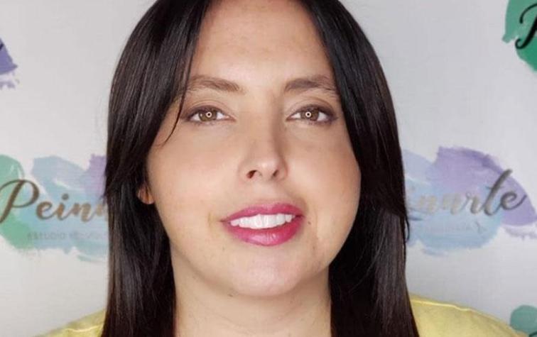 Ignacia Michelson hace alarde de sus cirugías con osada foto