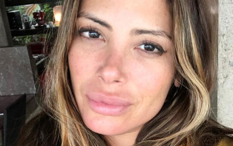 Roxana Muñoz luce irreconocible tras someterse a operación reconstructiva