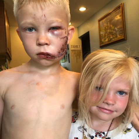 Chris Evans sorprendió a niño que salvó a su hermana del ataque de un perro