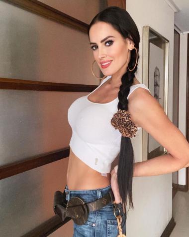 Adriana Barrientos muestra su rostro tras tratamiento estético