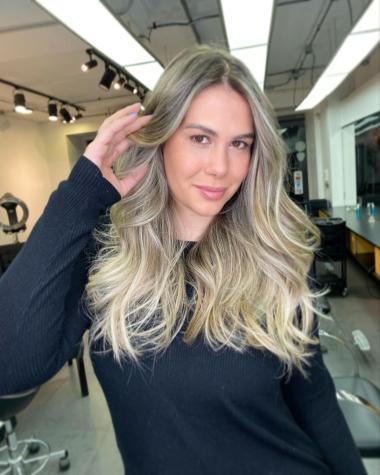 Laura Prieto recibe elogios al enseñar su dolor de espalda