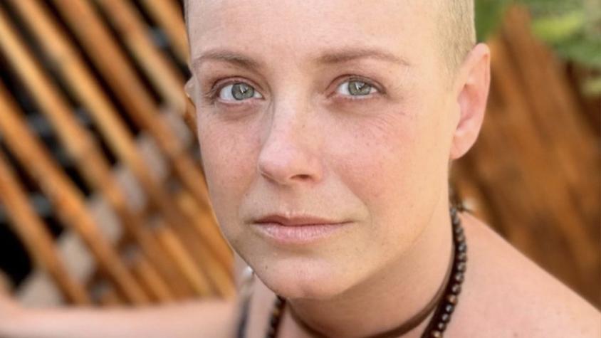 Claudia Conserva tomó drástica decisión tras vencer cáncer de mama