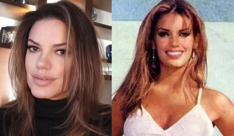Yulissa del Pino, recordada animadora de televisión, reveló compleja batalla contra el cáncer de piel